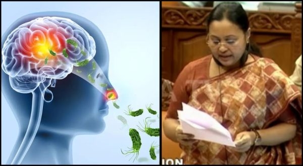 amoebic meningoencephalitis