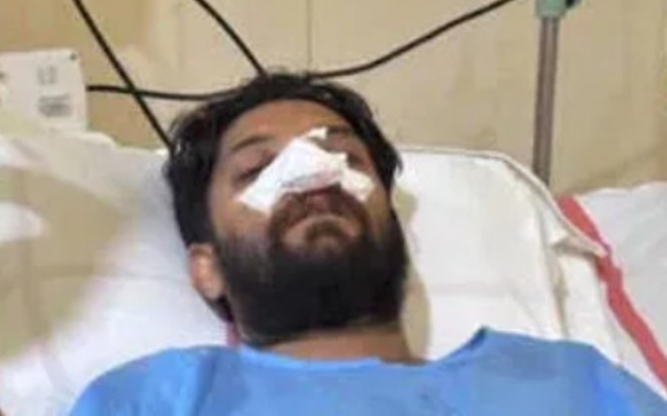 ഷാഫി പറമ്പിലിന് മർദ്ദനമേറ്റ സംഭവം; ആഭ്യന്തര മന്ത്രാലയത്തോട് റിപ്പോർട്ട് തേടി ലോക്സഭ സെക്രട്ടറിയേറ്റ് ഷാഫി പറമ്പിലിന് മർദ്ദനമേറ്റ സംഭവം; ആഭ്യന്തര മന്ത്രാലയത്തോട് റിപ്പോർട്ട് തേടി ലോക്സഭ സെക്രട്ടറിയേറ്റ്