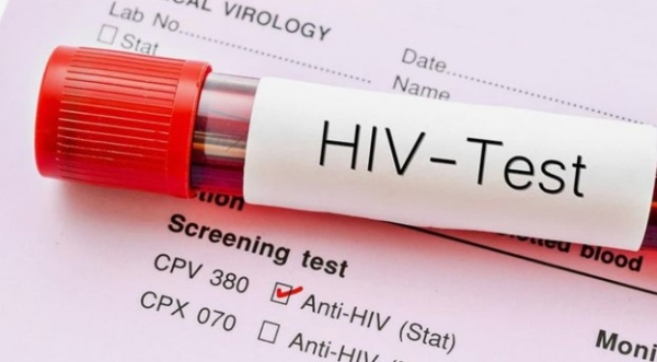 കേരളത്തിൽ കുതിച്ചുയർന്ന് എച്ച്ഐവി ബാധിതരുടെ എണ്ണം, ഏറെയും ജെൻ സി വിഭാഗം കേരളത്തിൽ കുതിച്ചുയർന്ന് എച്ച്ഐവി ബാധിതരുടെ എണ്ണം, ഏറെയും ജെൻ സി വിഭാഗം