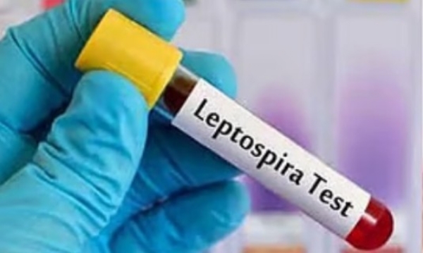 സംസ്ഥാനത്ത് പിടിവിട്ട് എലിപ്പനി; രോഗികൾ 5000 കടന്നു