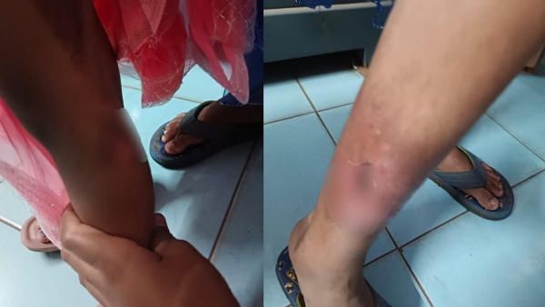 MINOR GIRLS ATTACKED MALAPPURAM