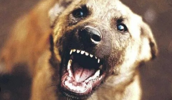 പാനൂരിൽ വീട്ടുമുറ്റത്ത് കളിക്കുന്നതിനിടെ 12 വയസ്സുകാരനെ തെരുവുനായ കടിച്ചു കീറി; മുഖത്ത് ഗുരുതര പരുക്ക്, പ്ലാസ്റ്റിക് സർജറി വേണ്ടിവരും പാനൂരിൽ വീട്ടുമുറ്റത്ത് കളിക്കുന്നതിനിടെ 12 വയസ്സുകാരനെ തെരുവുനായ കടിച്ചു കീറി; മുഖത്ത് ഗുരുതര പരുക്ക്, പ്ലാസ്റ്റിക് സർജറി വേണ്ടിവരും