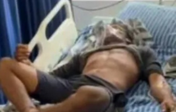 ബേപ്പൂരിൽ മത്സ്യബന്ധന ബോട്ടിലെ ടാങ്ക് വൃത്തിയാക്കുന്നതിനിടെ ശ്വാസംമുട്ടി തൊഴിലാളി മരിച്ചു; മൂന്ന് പേർ ചികിത്സയിൽ