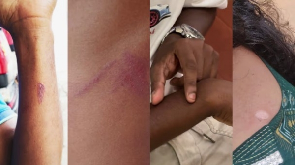 കേരളത്തിൽ കൊടുംചൂട് തുടരുന്നു; കോട്ടയത്ത് അഗ്നിരക്ഷാ സേനാംഗത്തിനും പാലക്കാട് രണ്ടുപേർക്കും സൂര്യാതപമേറ്റു