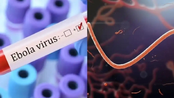 Ebola virus