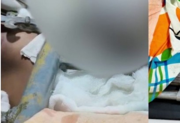 മാങ്ങ പറിക്കുന്നതിനിടെ ടെറസിൽനിന്ന് താഴെ വീണ് പതിനാറുകാരന് ഗുരുതര പരുക്ക്; കഴുത്തിൽ ഗേറ്റിന്റെ കമ്പി തുളച്ചുകയറി