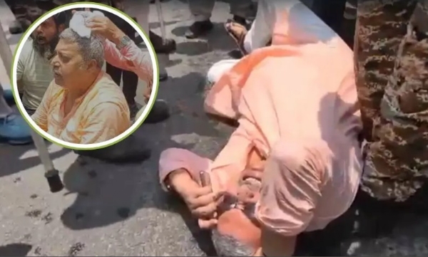 പശ്ചിമ ബംഗാളിൽ വീണ്ടും സംഘർഷം: അഭിഷേക് ബാനർജിക്ക് പിന്നാലെ തൃണമൂൽ എം.പി കല്യാൺ ബാനർജിക്ക് നേരെയും ആക്രമണം; തലയ്ക്ക് പരിക്ക്