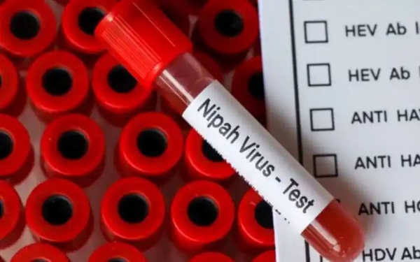 Nipah virus Nipah virus