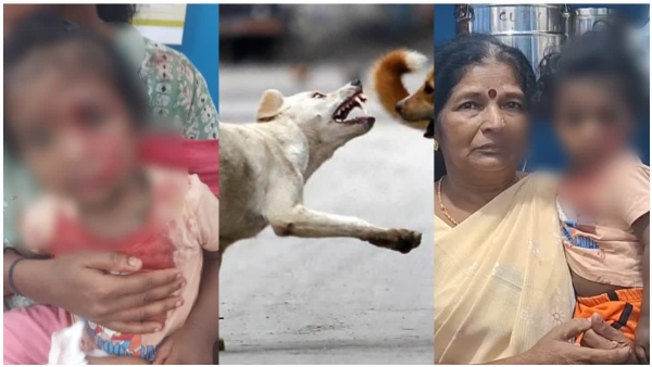 Street dog attack
