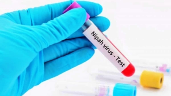 Nipah virus