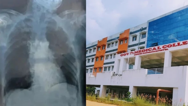 Medical negligence Medical negligence